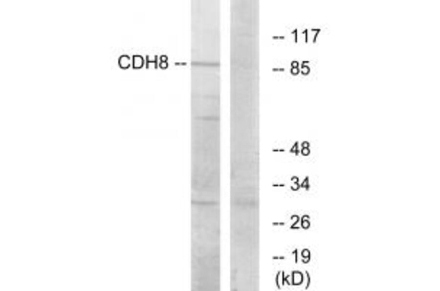 Western blot - CDH8 Antibody from Signalway Antibody (34180) - Antibodies.com