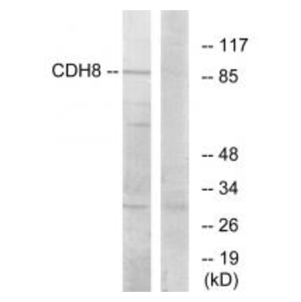 Western blot - CDH8 Antibody from Signalway Antibody (34180) - Antibodies.com
