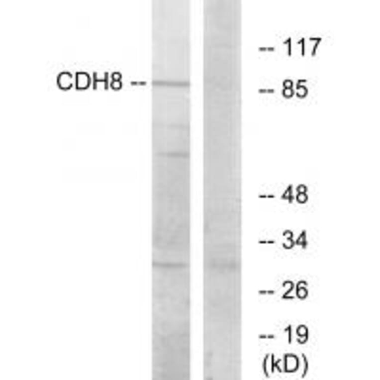 Western blot - CDH8 Antibody from Signalway Antibody (34180) - Antibodies.com