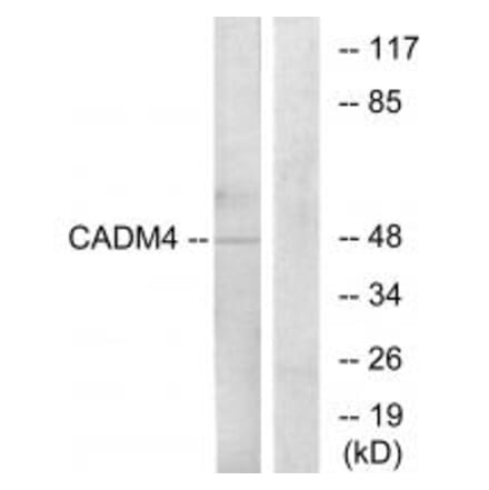 Western blot - CADM4 Antibody from Signalway Antibody (34183) - Antibodies.com