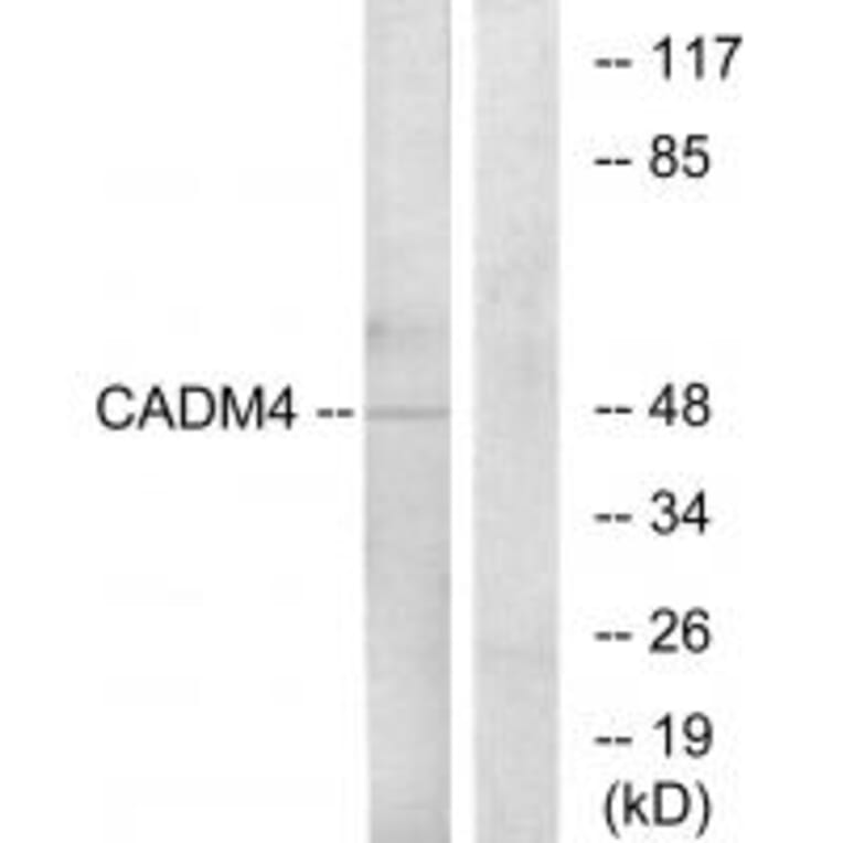 Western blot - CADM4 Antibody from Signalway Antibody (34183) - Antibodies.com