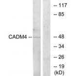 Western blot - CADM4 Antibody from Signalway Antibody (34183) - Antibodies.com