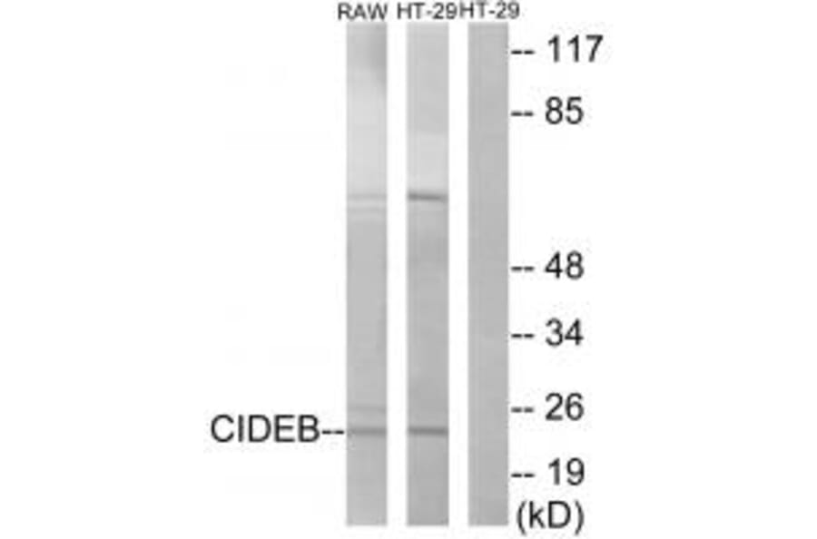 Western blot - CIDEB Antibody from Signalway Antibody (34263) - Antibodies.com