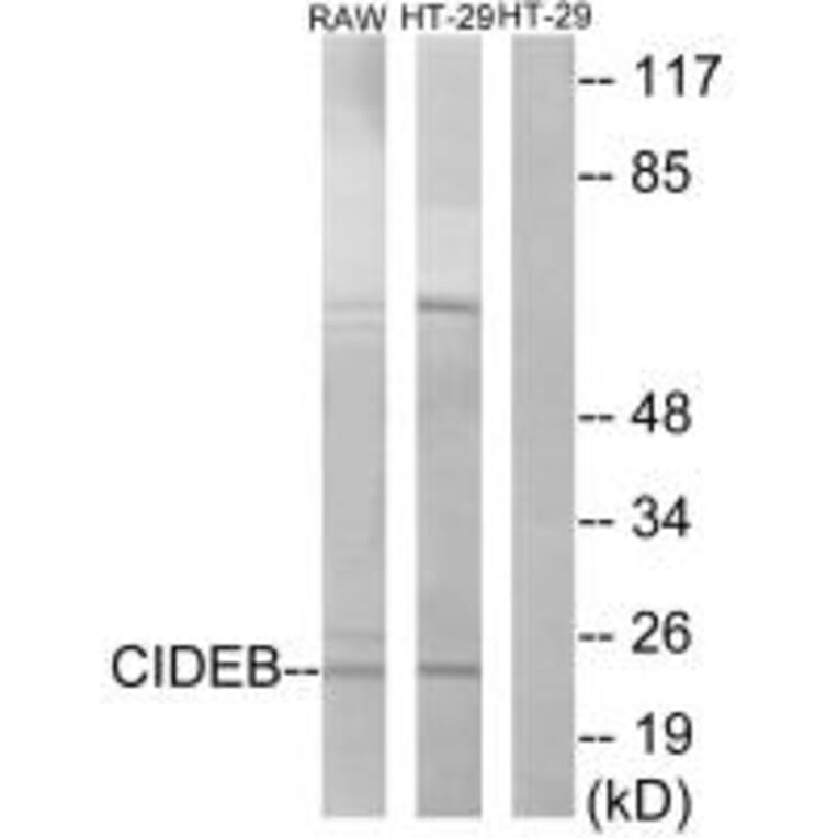 Western blot - CIDEB Antibody from Signalway Antibody (34263) - Antibodies.com