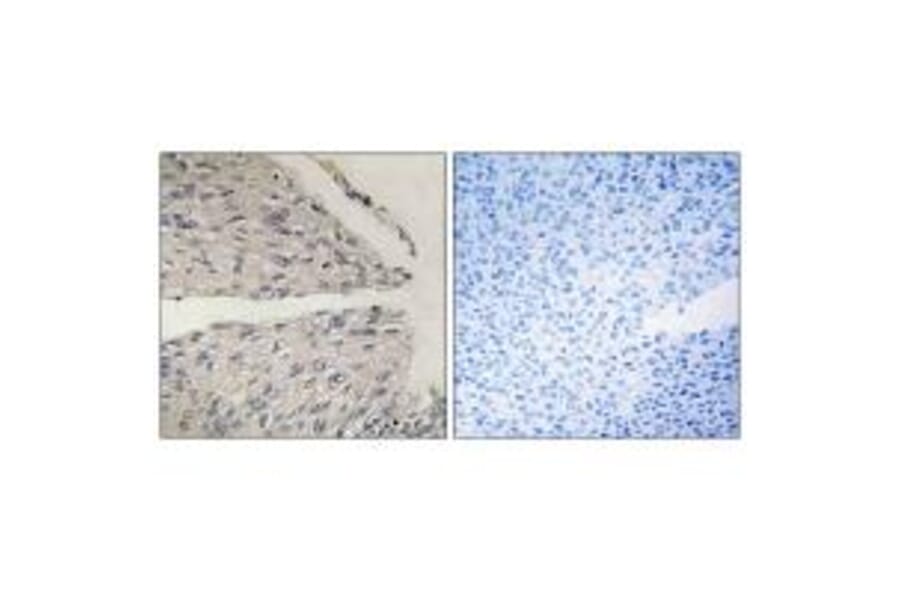 Immunohistochemistry - CIDEB Antibody from Signalway Antibody (34263) - Antibodies.com