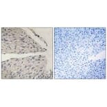 Immunohistochemistry - CIDEB Antibody from Signalway Antibody (34263) - Antibodies.com