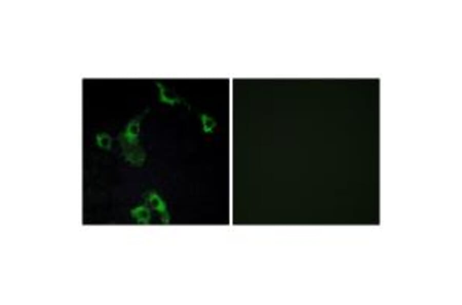 Immunofluorescence - CIDEB Antibody from Signalway Antibody (34263) - Antibodies.com