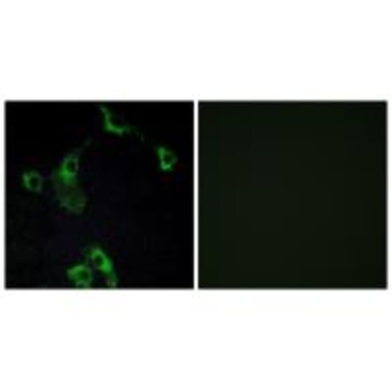 Immunofluorescence - CIDEB Antibody from Signalway Antibody (34263) - Antibodies.com