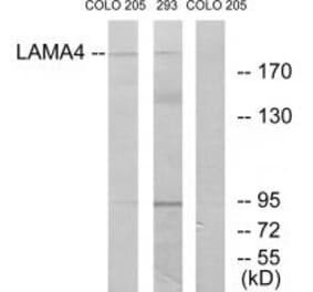 Western blot - LAMA4 Antibody from Signalway Antibody (34274) - Antibodies.com