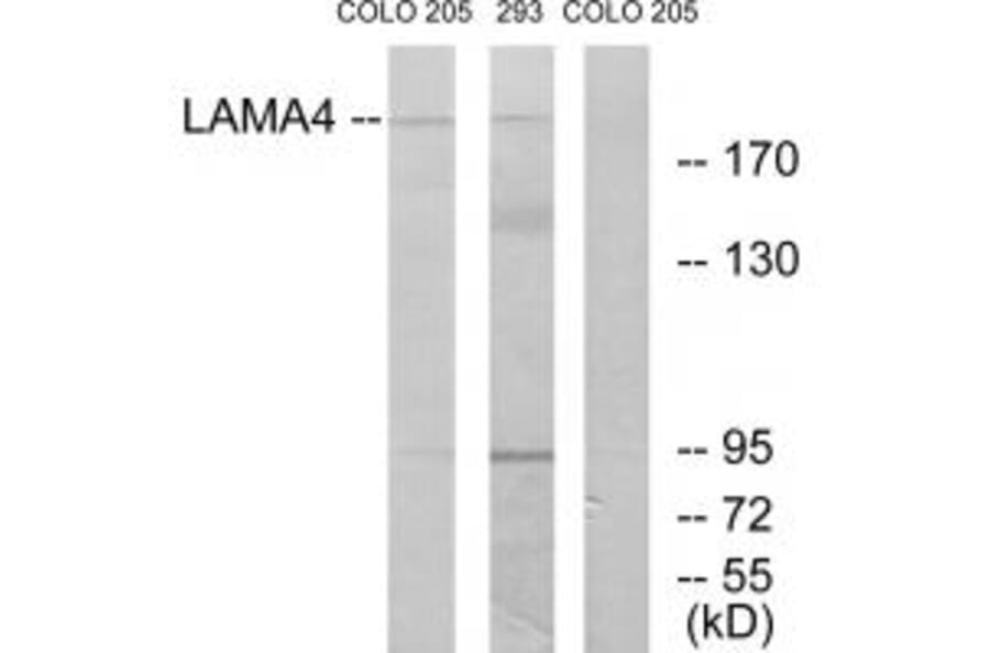 Western blot - LAMA4 Antibody from Signalway Antibody (34274) - Antibodies.com
