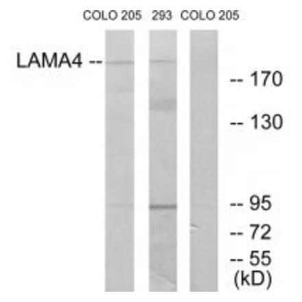 Western blot - LAMA4 Antibody from Signalway Antibody (34274) - Antibodies.com