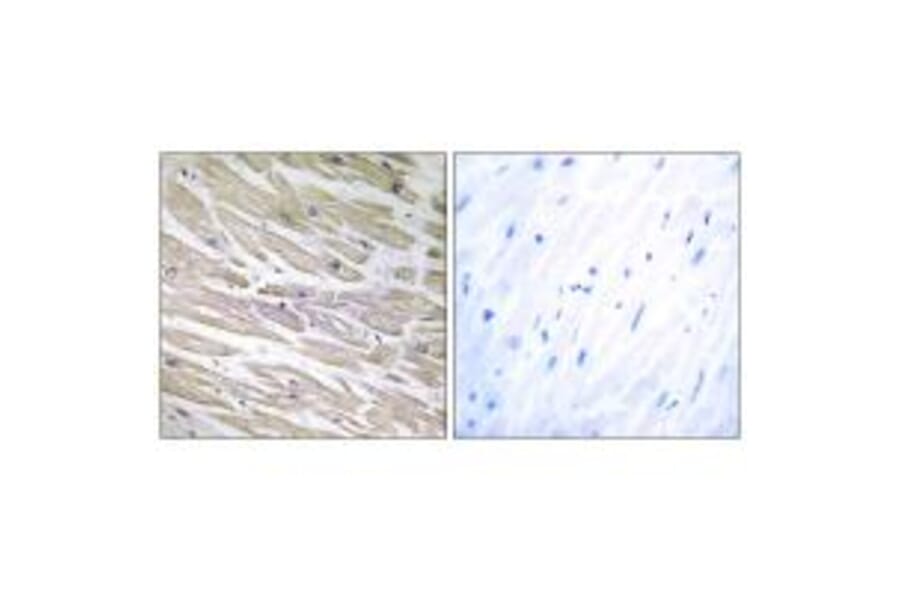 Immunohistochemistry - LAMA4 Antibody from Signalway Antibody (34274) - Antibodies.com