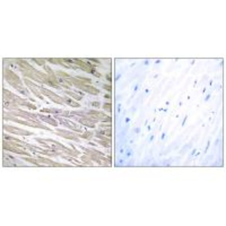 Immunohistochemistry - LAMA4 Antibody from Signalway Antibody (34274) - Antibodies.com