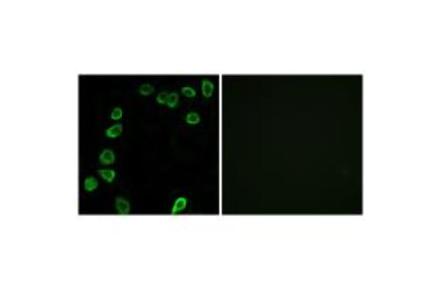 Immunofluorescence - LAMA4 Antibody from Signalway Antibody (34274) - Antibodies.com