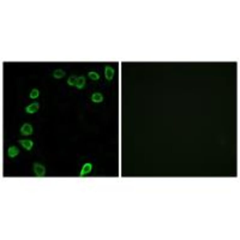 Immunofluorescence - LAMA4 Antibody from Signalway Antibody (34274) - Antibodies.com