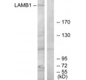 Western blot - LAMB1 Antibody from Signalway Antibody (34276) - Antibodies.com