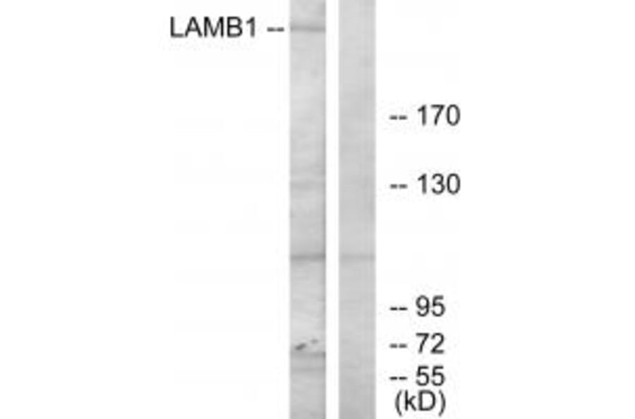 Western blot - LAMB1 Antibody from Signalway Antibody (34276) - Antibodies.com