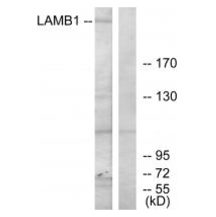 Western blot - LAMB1 Antibody from Signalway Antibody (34276) - Antibodies.com