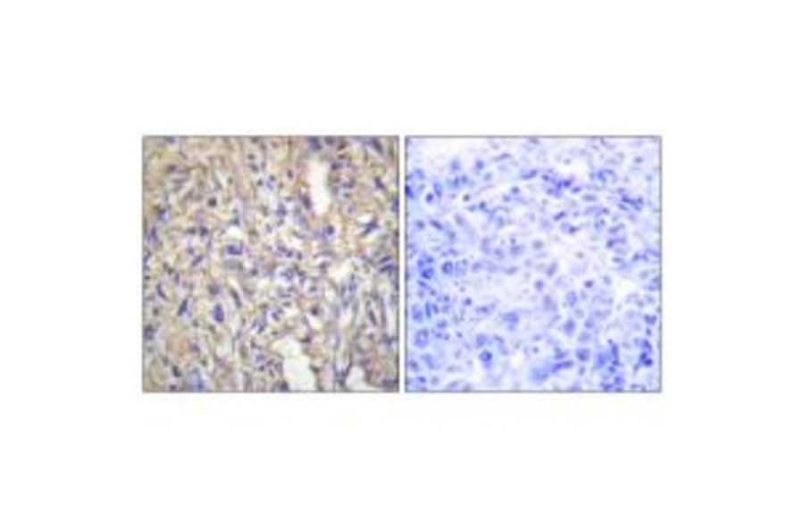 Immunohistochemistry - LAMB1 Antibody from Signalway Antibody (34276) - Antibodies.com