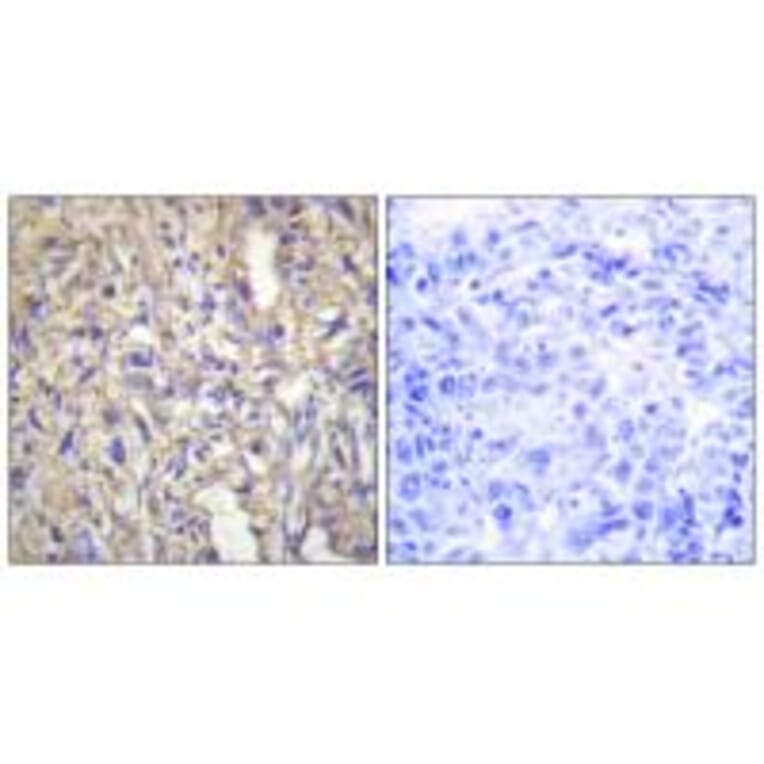 Immunohistochemistry - LAMB1 Antibody from Signalway Antibody (34276) - Antibodies.com