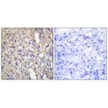 Immunohistochemistry - LAMB1 Antibody from Signalway Antibody (34276) - Antibodies.com