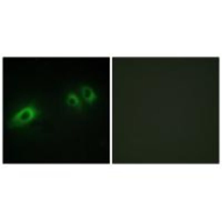 Immunofluorescence - LAMB1 Antibody from Signalway Antibody (34276) - Antibodies.com
