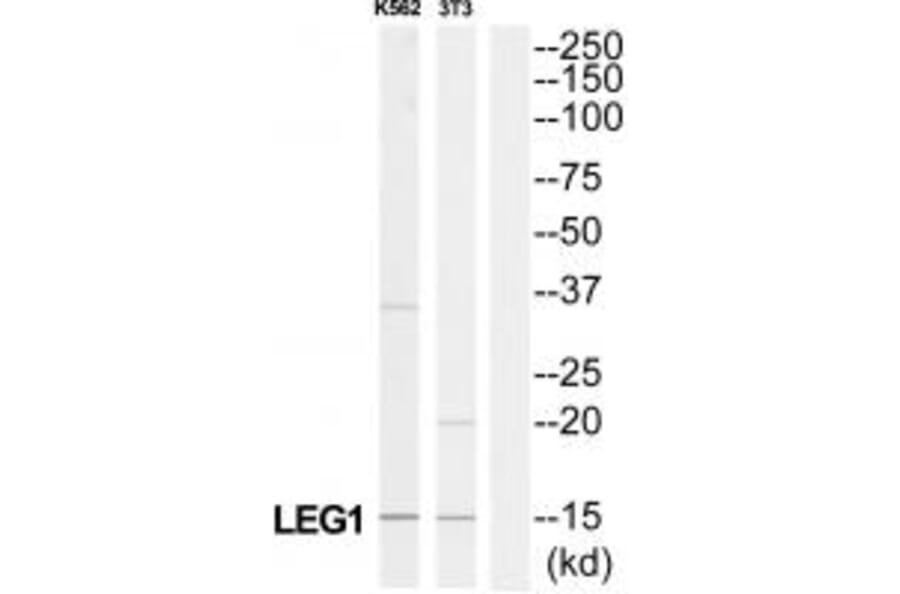 Western blot - LAMC3 Antibody from Signalway Antibody (34280) - Antibodies.com