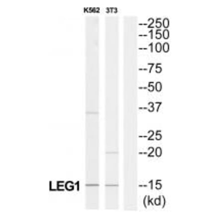 Western blot - LAMC3 Antibody from Signalway Antibody (34280) - Antibodies.com