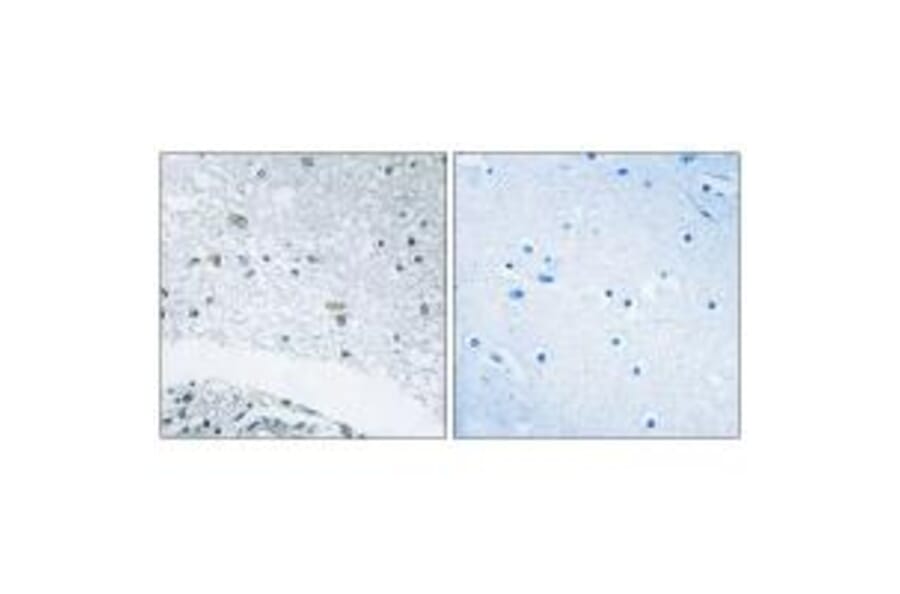 Immunohistochemistry - LAMC3 Antibody from Signalway Antibody (34280) - Antibodies.com