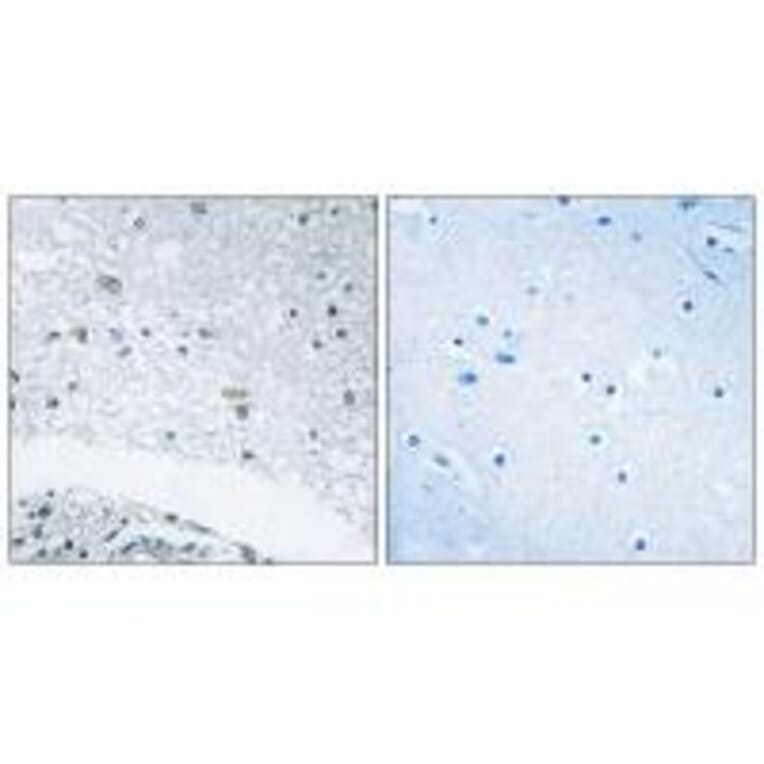 Immunohistochemistry - LAMC3 Antibody from Signalway Antibody (34280) - Antibodies.com