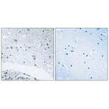 Immunohistochemistry - LAMC3 Antibody from Signalway Antibody (34280) - Antibodies.com