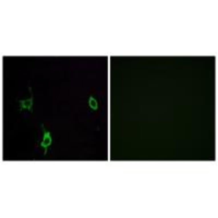 Immunofluorescence - LAMC3 Antibody from Signalway Antibody (34280) - Antibodies.com