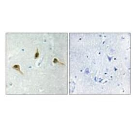 Immunohistochemistry - MSH2 Antibody from Signalway Antibody (34289) - Antibodies.com