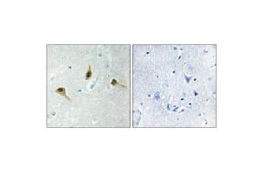 Immunohistochemistry - MSH2 Antibody from Signalway Antibody (34289) - Antibodies.com