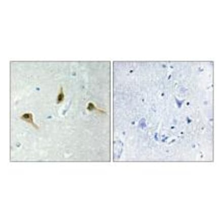 Immunohistochemistry - MSH2 Antibody from Signalway Antibody (34289) - Antibodies.com