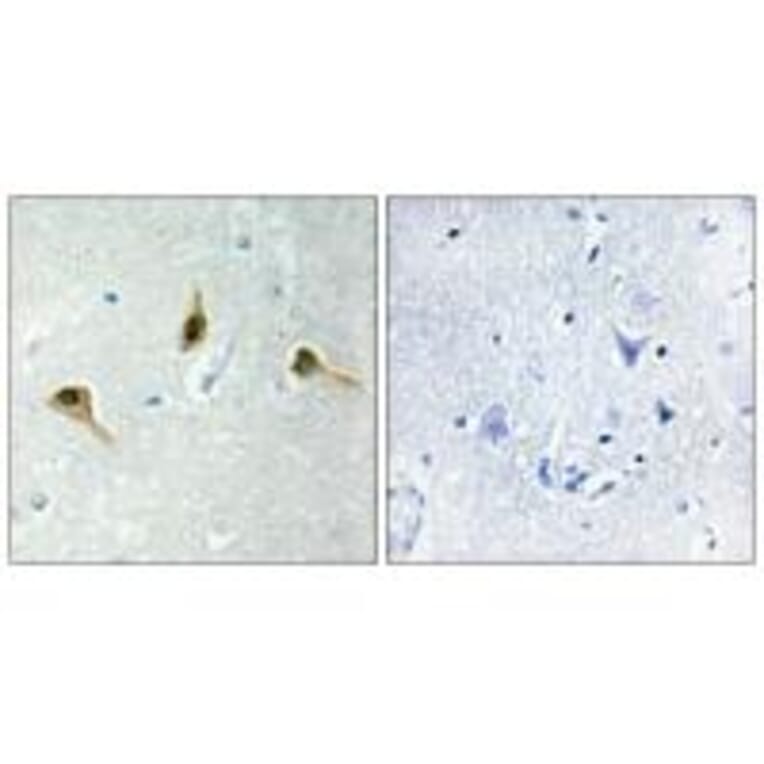 Immunohistochemistry - MSH2 Antibody from Signalway Antibody (34289) - Antibodies.com