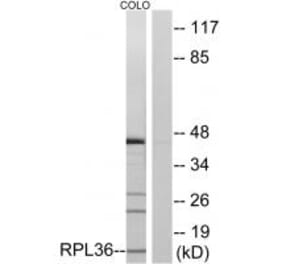 Western blot - RPL36 Antibody from Signalway Antibody (34358) - Antibodies.com