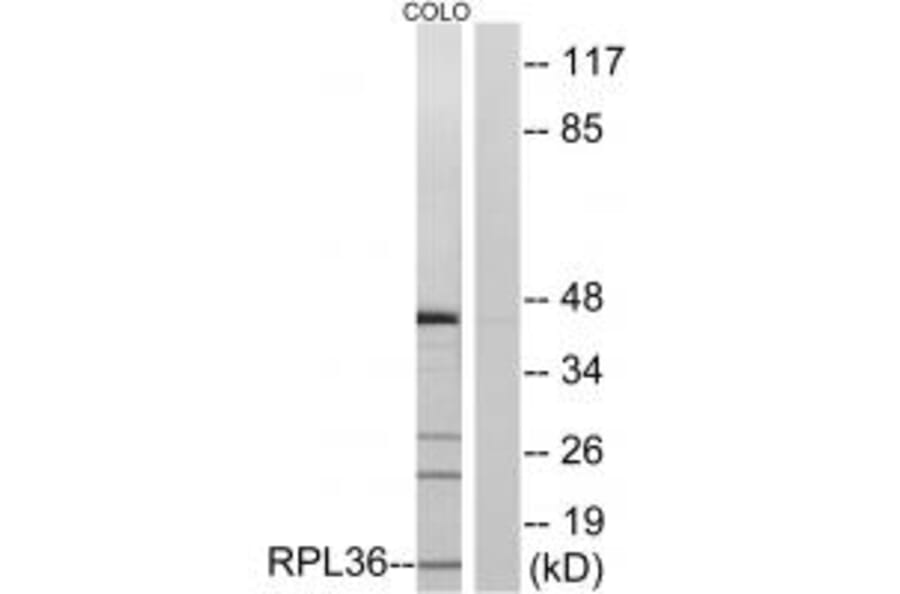Western blot - RPL36 Antibody from Signalway Antibody (34358) - Antibodies.com