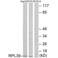 Western blot analysis of extracts from HepG2 cells and COLO cells, using RPL39 antibody #34359.