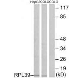 Western blot - RPL39 Antibody from Signalway Antibody (34359) - Antibodies.com