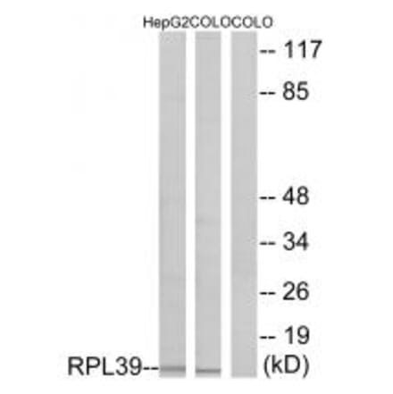 Western blot - RPL39 Antibody from Signalway Antibody (34359) - Antibodies.com