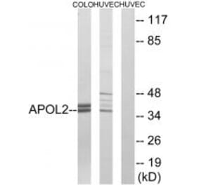 Western blot - APOL2 Antibody from Signalway Antibody (34432) - Antibodies.com