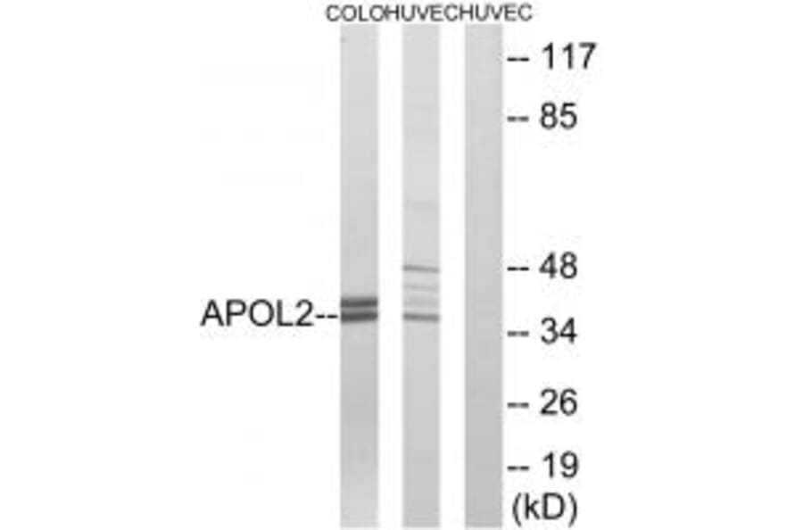 Western blot - APOL2 Antibody from Signalway Antibody (34432) - Antibodies.com