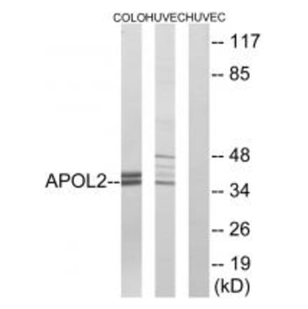 Western blot - APOL2 Antibody from Signalway Antibody (34432) - Antibodies.com