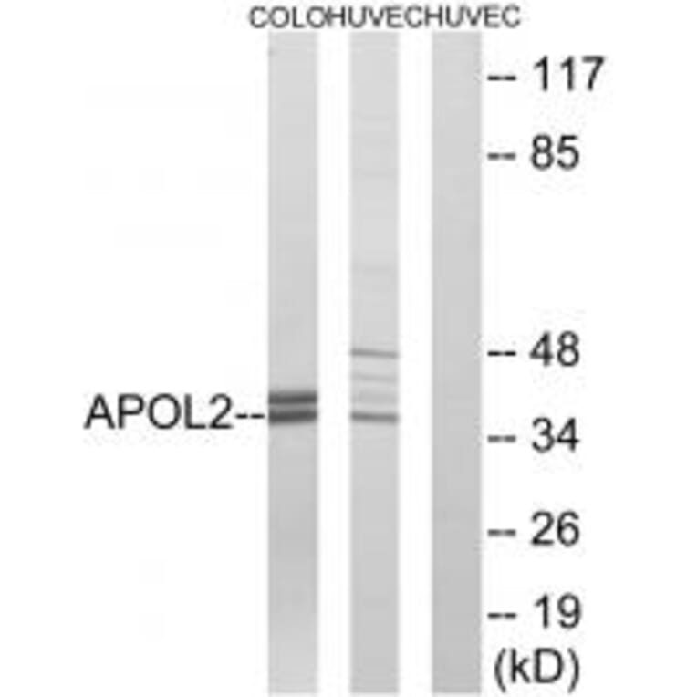 Western blot - APOL2 Antibody from Signalway Antibody (34432) - Antibodies.com