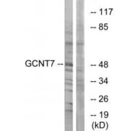 Western blot - GCNT7 Antibody from Signalway Antibody (34485) - Antibodies.com