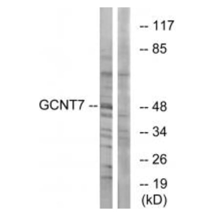 Western blot - GCNT7 Antibody from Signalway Antibody (34485) - Antibodies.com