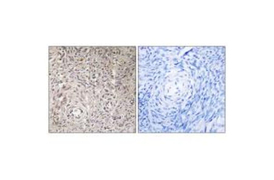 Immunohistochemistry - GCNT7 Antibody from Signalway Antibody (34485) - Antibodies.com