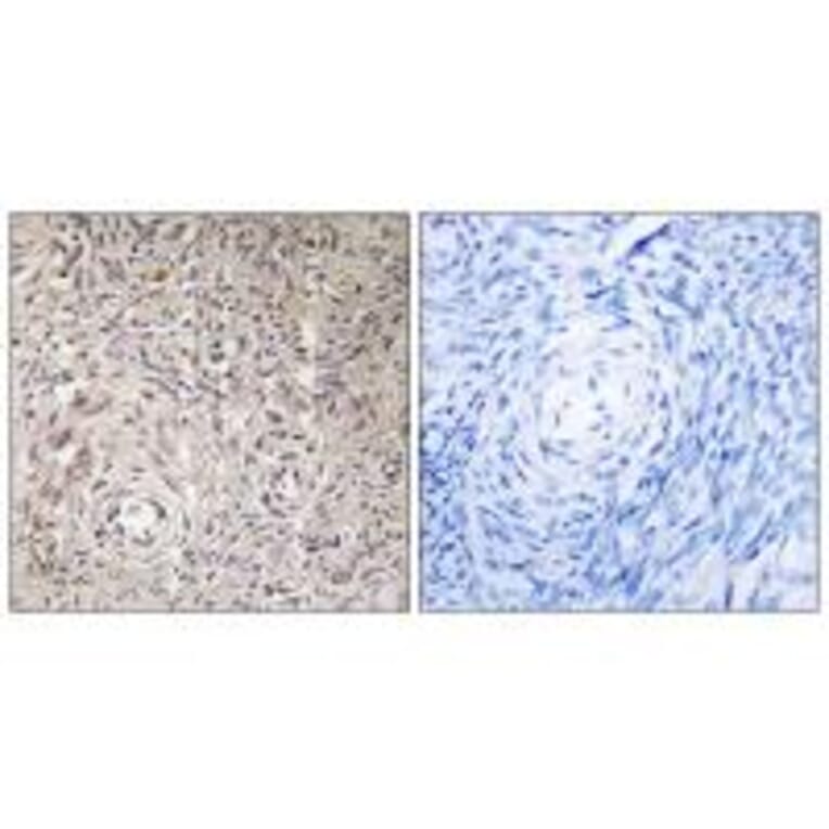 Immunohistochemistry - GCNT7 Antibody from Signalway Antibody (34485) - Antibodies.com