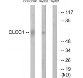 Western blot - CLCC1 Antibody from Signalway Antibody (34578) - Antibodies.com